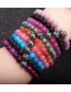 Fashion Color Mixing Volcanic Stone Malachite Agate Beaded Ball Bracelet